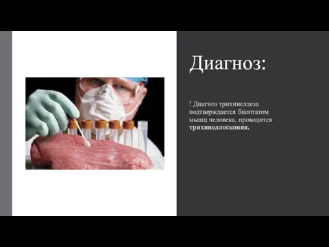 Диагноз: ! Диагноз трихинеллеза подтверждается биоптатом мышц человека, проводится трихинеллоскопия.