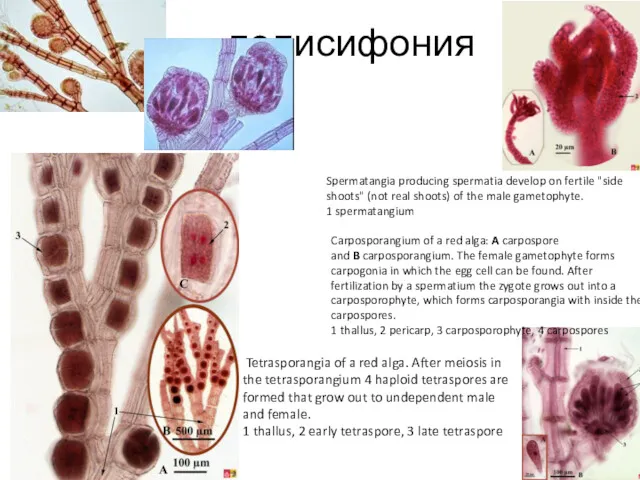 Tetrasporangia of a red alga. After meiosis in the tetrasporangium