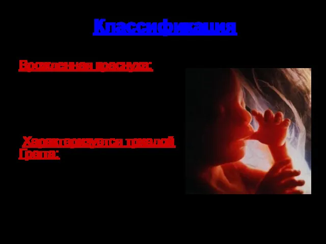 Классификация Врожденная краснуха: Развивается при внутриутробном заражении. Может развиться и после бессимптомной (иннапарантной)