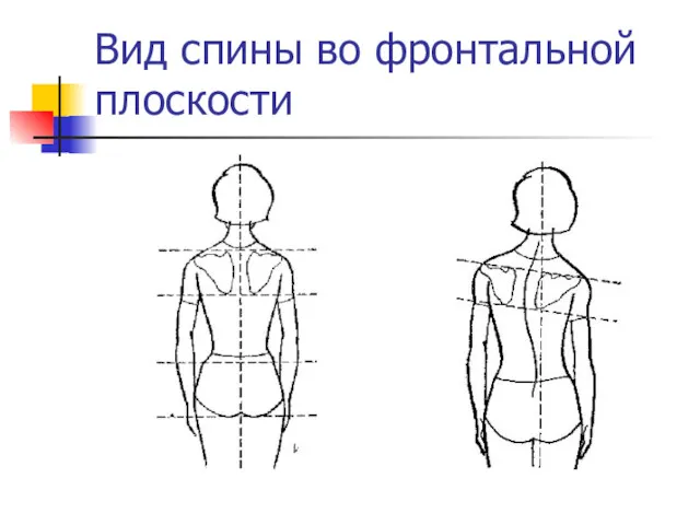 Вид спины во фронтальной плоскости