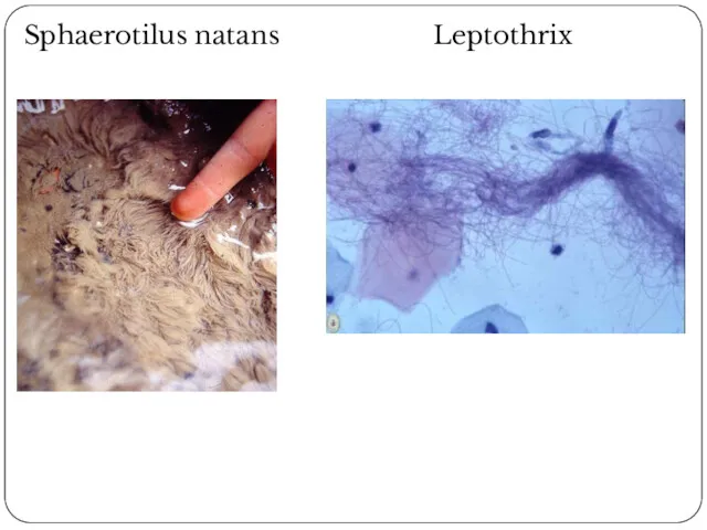 Sphaerotilus natans Leptothrix