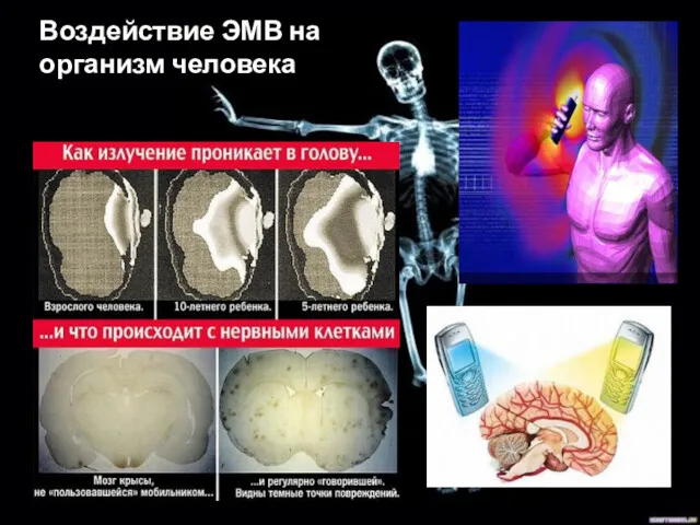 Воздействие ЭМВ на организм человека