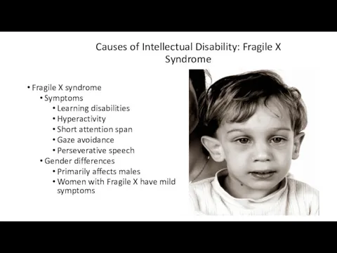Causes of Intellectual Disability: Fragile X Syndrome Fragile X syndrome Symptoms Learning disabilities