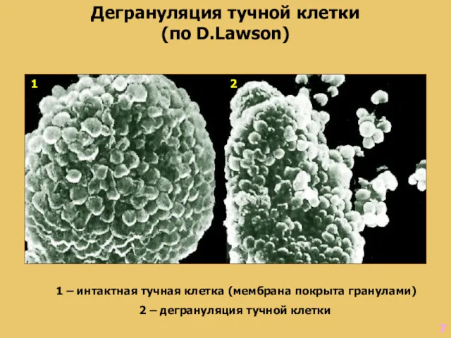 Дегрануляция тучной клетки (по D.Lawson) 1 – интактная тучная клетка (мембрана покрыта гранулами)