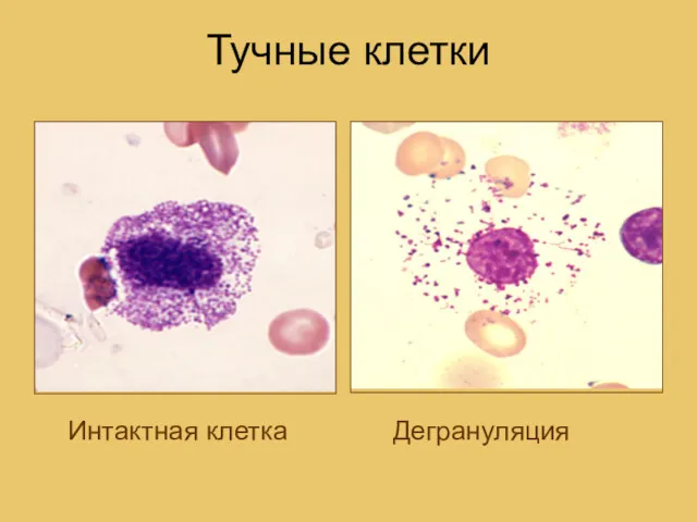 Тучные клетки Интактная клетка Дегрануляция
