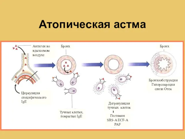 Антиген во вдыхаемом воздухе Циркуляция специфического IgE Бронх Тучные клетки, покрытые IgE Дегрануляция