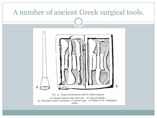 A number of ancient Greek surgical tools.