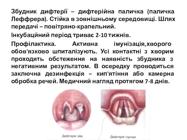 Збудник дифтерії – дифтерійна паличка (паличка Леффрера). Стійка в зовнішньому