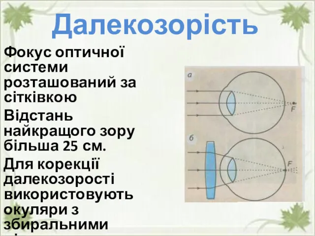 Далекозорість Фокус оптичної системи розташований за сітківкою Відстань найкращого зору більша 25 см.