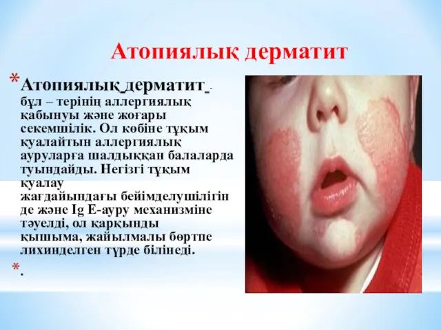 Атопиялық дерматит -бұл – терінің аллергиялық қабынуы және жоғары секемшілік. Ол көбіне тұқым