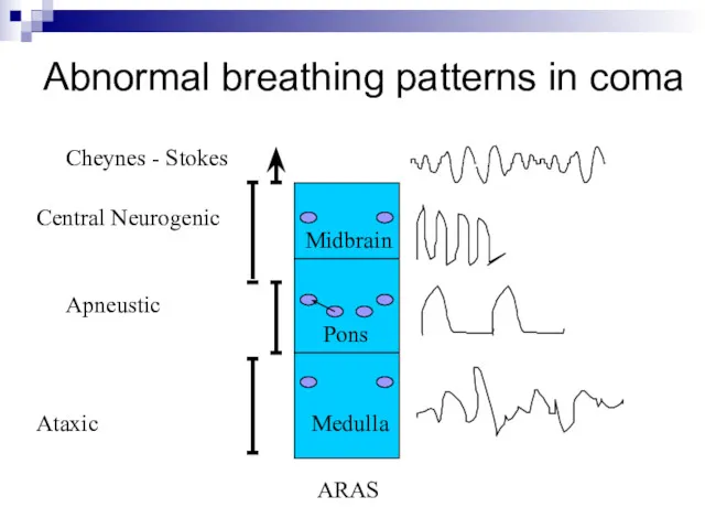 Abnormal breathing patterns in coma Midbrain Pons Medulla ARAS Cheynes - Stokes Ataxic Apneustic Central Neurogenic