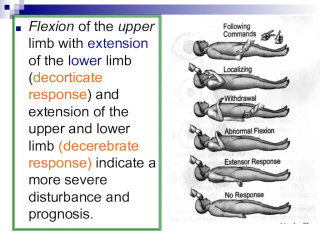 Flexion of the upper limb with extension of the lower