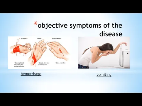 objective symptoms of the disease hemorrhage vomiting