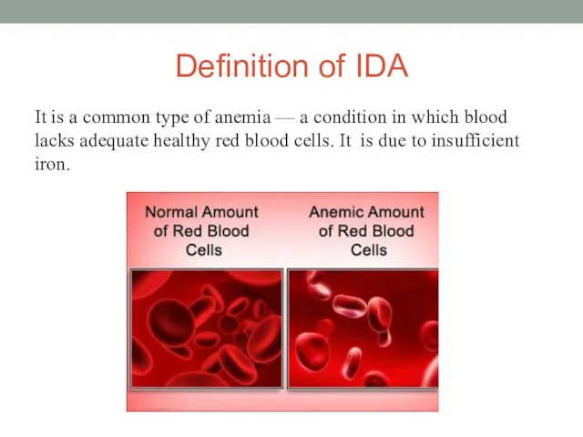 Definition of IDA It is a common type of anemia