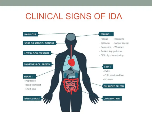 CLINICAL SIGNS OF IDA