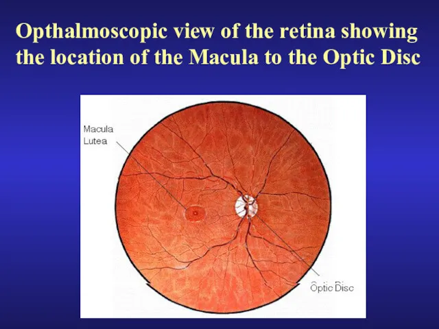 Opthalmoscopic view of the retina showing the location of the Macula to the Optic Disc