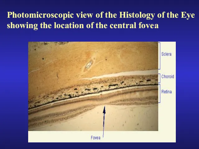Photomicroscopic view of the Histology of the Eye showing the location of the central fovea