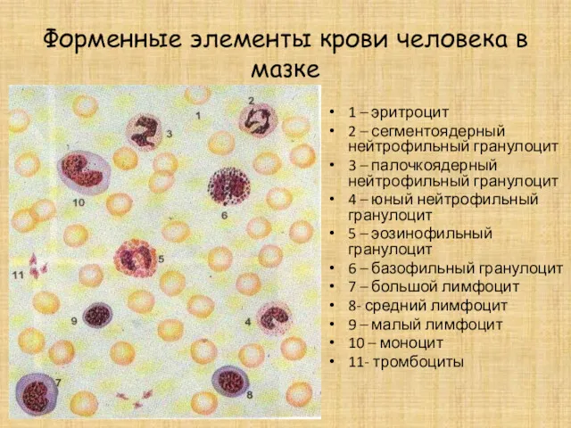 Форменные элементы крови человека в мазке 1 – эритроцит 2