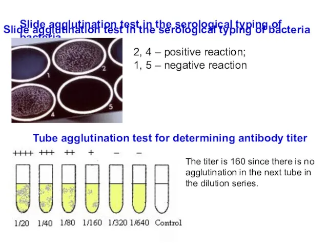 Slide agglutination test in the serological typing of bacteria Slide