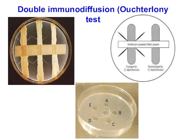 Double immunodiffusion (Ouchterlony test