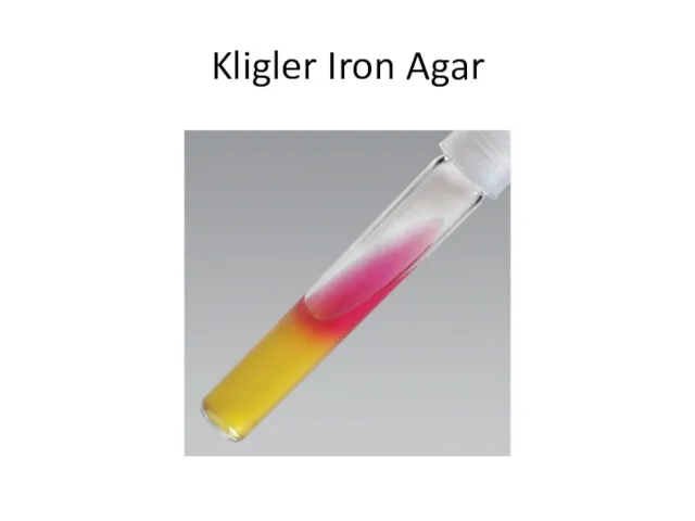 Kligler Iron Agar