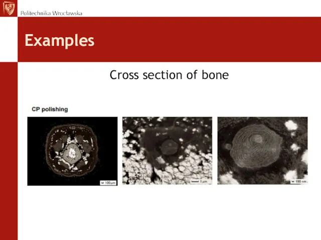 Examples Cross section of bone