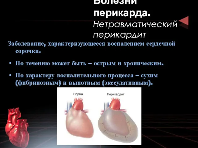 Заболевание, характеризующееся воспалением сердечной сорочки. По течению может быть – острым и хроническим.