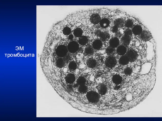 ЭМ тромбоцита