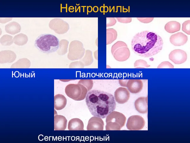 Нейтрофилы Юный Палочкоядерный Сегментоядерный