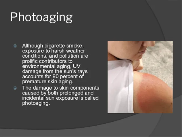 Photoaging Although cigarette smoke, exposure to harsh weather conditions, and pollution are prolific