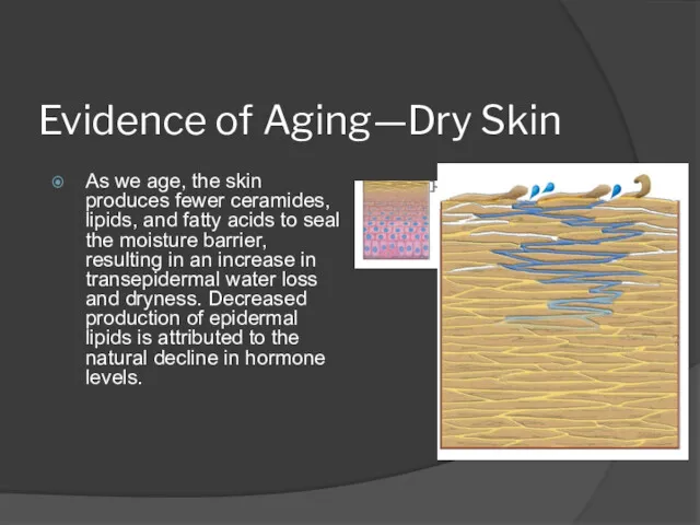 Evidence of Aging—Dry Skin As we age, the skin produces fewer ceramides, lipids,