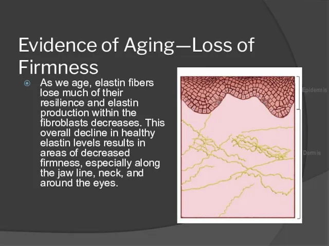 Evidence of Aging—Loss of Firmness As we age, elastin fibers lose much of