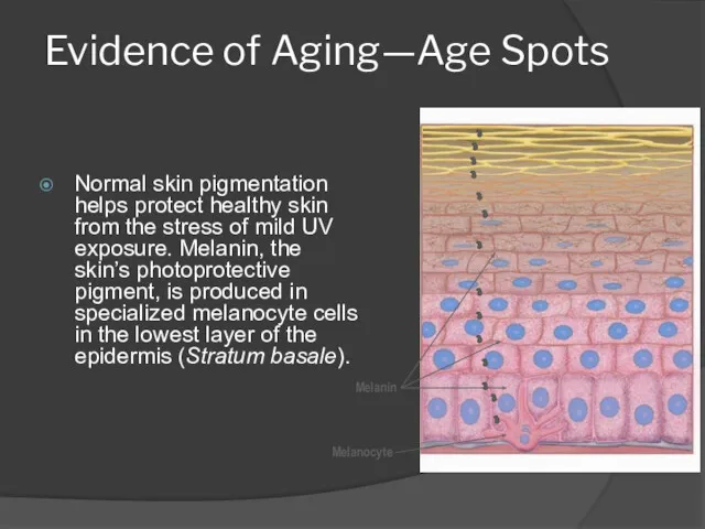 Evidence of Aging—Age Spots Normal skin pigmentation helps protect healthy skin from the