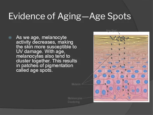 Evidence of Aging—Age Spots As we age, melanocyte activity decreases, making the skin