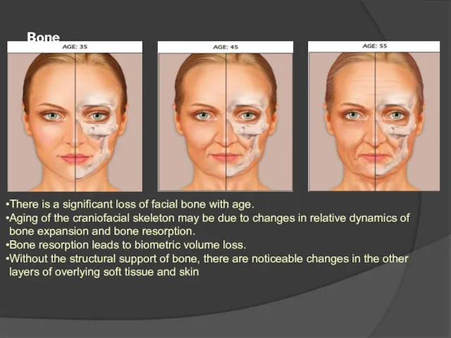 Bone There is a significant loss of facial bone with