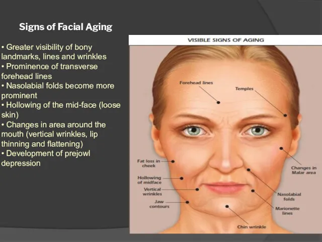Signs of Facial Aging • Greater visibility of bony landmarks, lines and wrinkles