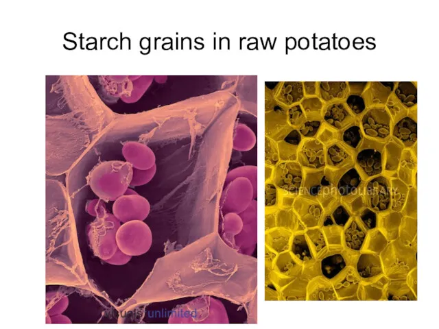Starch grains in raw potatoes