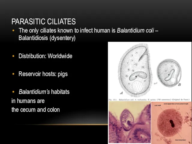 PARASITIC CILIATES The only ciliates known to infect human is