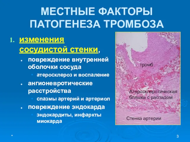 МЕСТНЫЕ ФАКТОРЫ ПАТОГЕНЕЗА ТРОМБОЗА изменения сосудистой стенки, повреждение внутренней оболочки