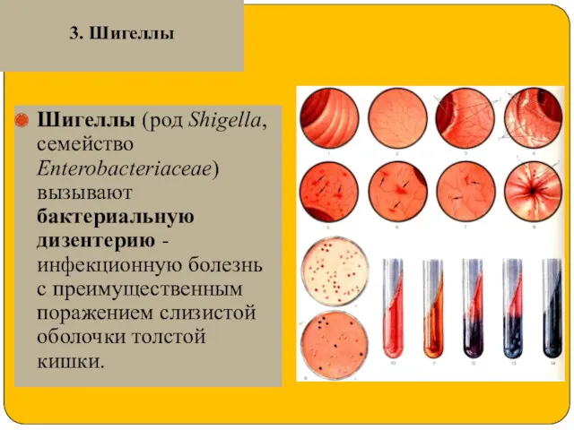 3. Шигеллы Шигеллы (род Shigella, семейство Enterobacteriaceae) вызывают бактериальную дизентерию