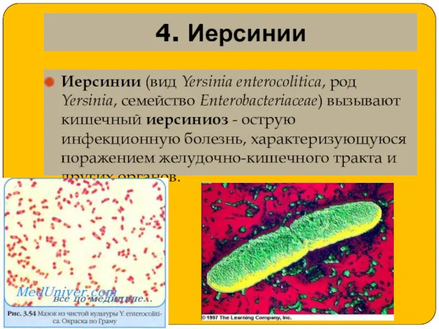 4. Иерсинии Иерсинии (вид Yersinia enterocolitica, род Yersinia, семейство Enterobacteriaceae)