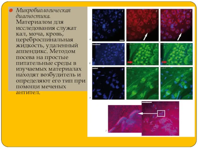 Микробиологическая диагностика. Материалом для исследования служат кал, моча, кровь, цереброспинальная