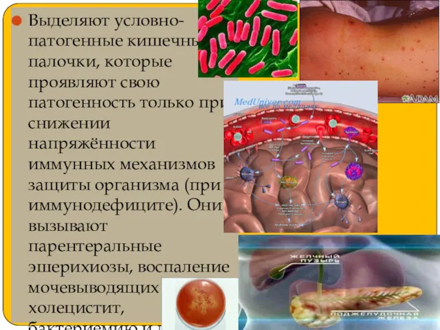 Выделяют условно-патогенные кишечные палочки, которые проявляют свою патогенность только при