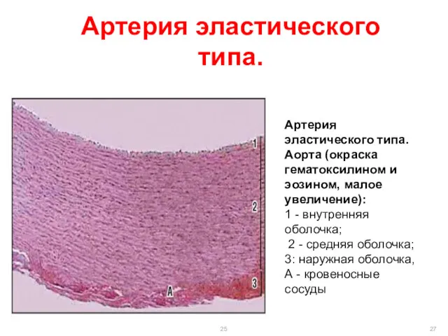 Артерия эластического типа. Артерия эластического типа. Аорта (окраска гематоксилином и