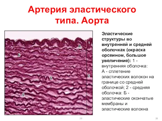 Артерия эластического типа. Аорта Эластические структуры во внутренней и средней