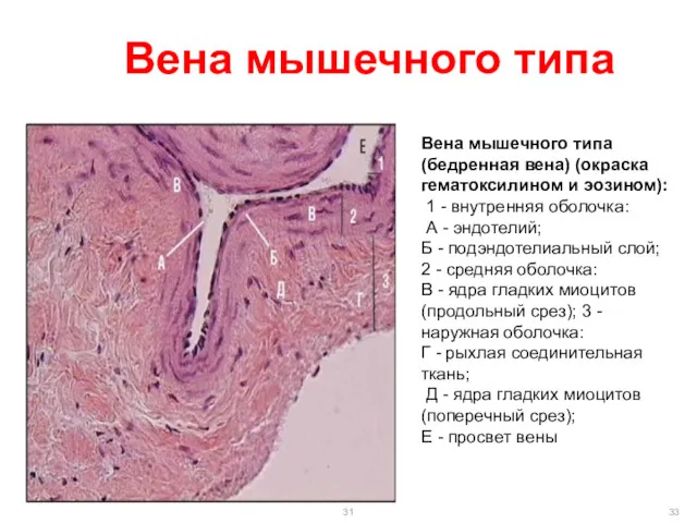 Вена мышечного типа Вена мышечного типа (бедренная вена) (окраска гематоксилином