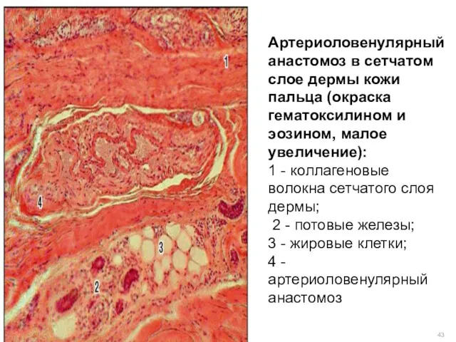 Артериоловенулярный анастомоз в сетчатом слое дермы кожи пальца (окраска гематоксилином
