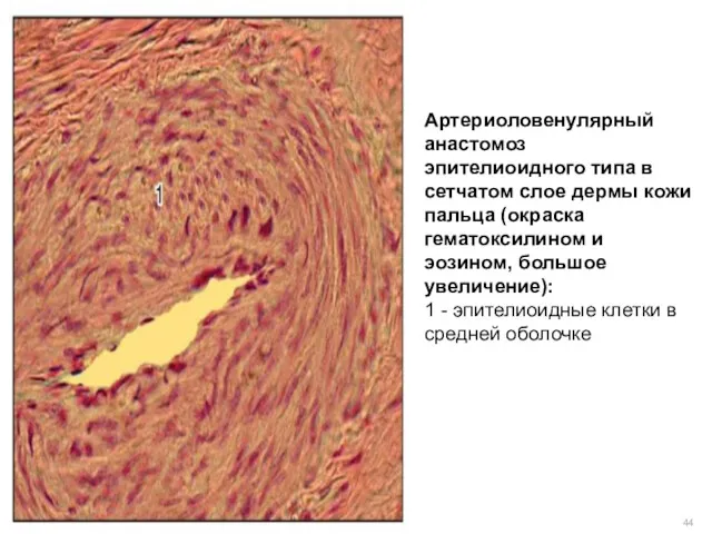 Артериоловенулярный анастомоз эпителиоидного типа в сетчатом слое дермы кожи пальца