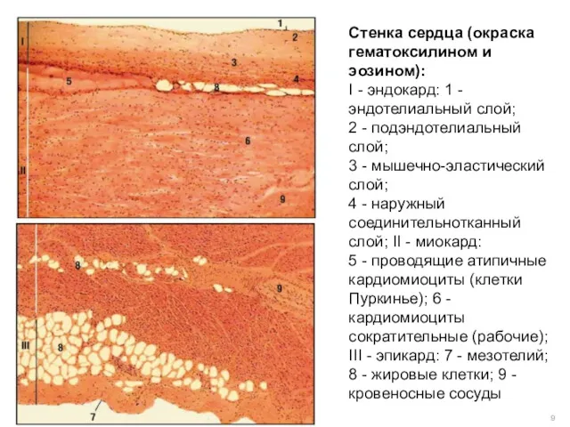 Стенка сердца (окраска гематоксилином и эозином): I - эндокард: 1