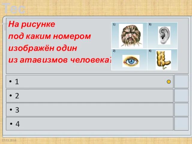 22.03.2016 На рисунке под каким номером изображён один из атавизмов человека? 1 2 3 4